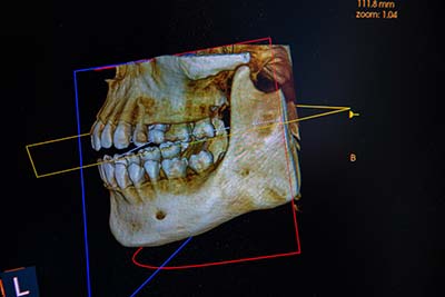 cone beam CT