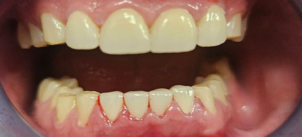 After image
