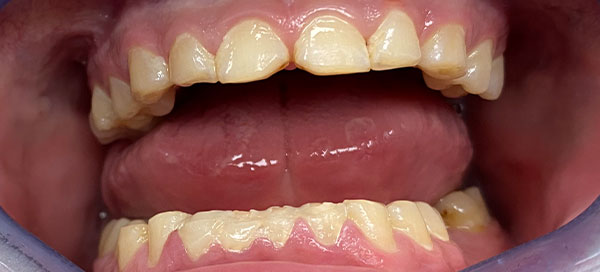Before image
